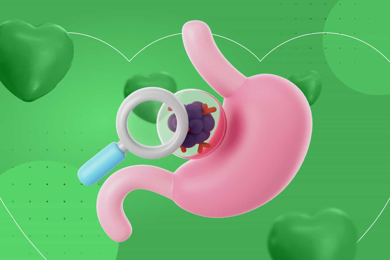 Чек-ап Гастроэнтерологический