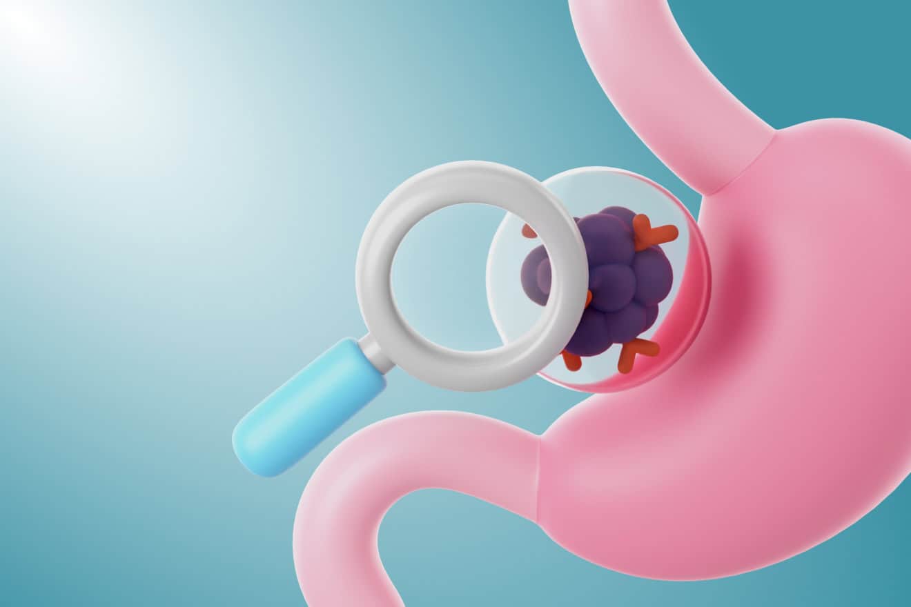 Гастро Check-up