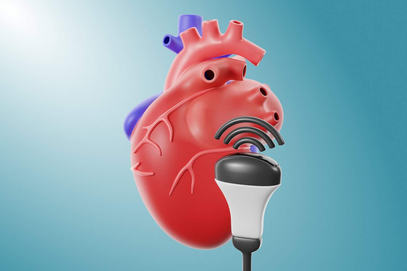 УЗИ сердца (эхокардиография)