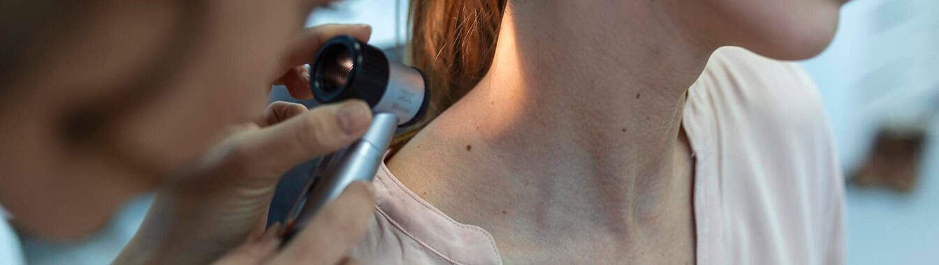 Бородавки (ВПЧ-инфекция)