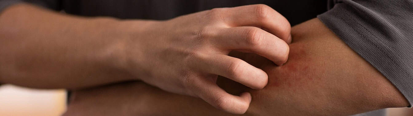 Контактный дерматит