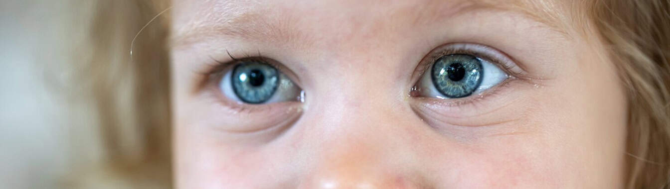 Глаукома у детей
