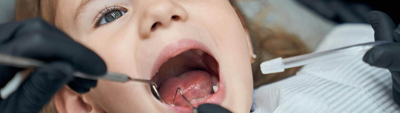 Повреждения зубов (переломы, трещины)