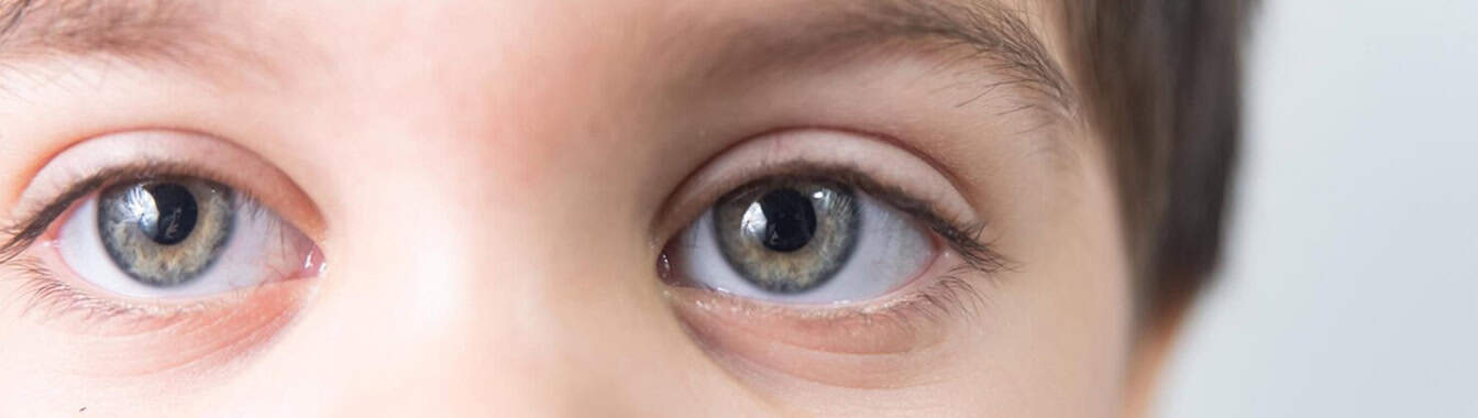 Воспаление или повреждение роговицы