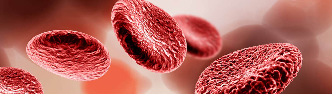 Заболевания сосудов (синдром Кавасаки)