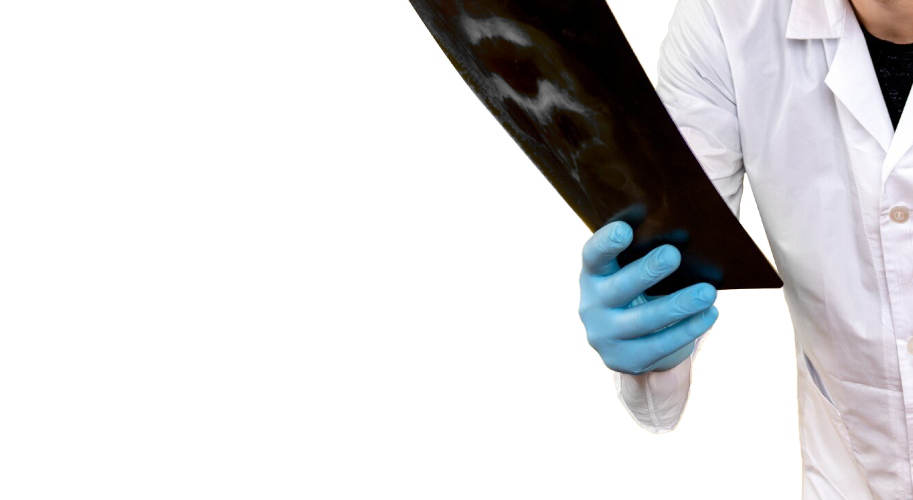 Аллергический ринит